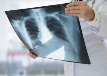 Νέα startup λαμβάνει επένδυση $62,000,000 για τη θεραπεία της πνευμονοπάθειας