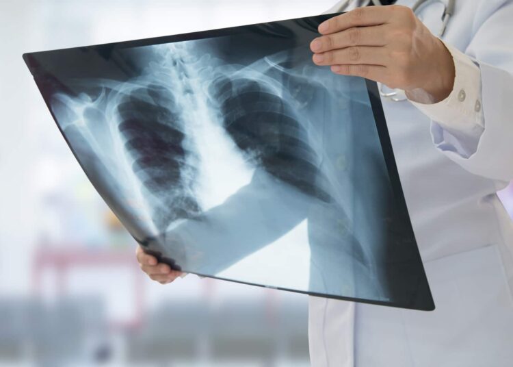 Νέα startup λαμβάνει επένδυση $62,000,000 για τη θεραπεία της πνευμονοπάθειας