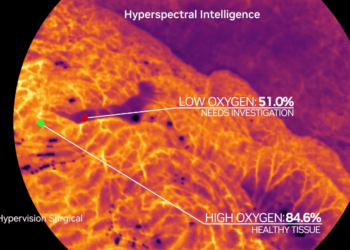 Η Hypervision Surgical συγκεντρώνει 7,5 εκατ. ευρώ για να επαναπροσδιορίσει τη χειρουργική απεικόνιση με τεχνητή νοημοσύνη και κλινική υπολογιστική ακμή